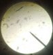 Observation au mircroscope des levures et bactéries (2)